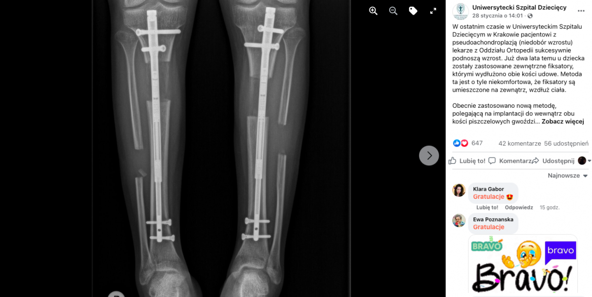 Fot. Uniwersytecki Szpital Dziecięcy