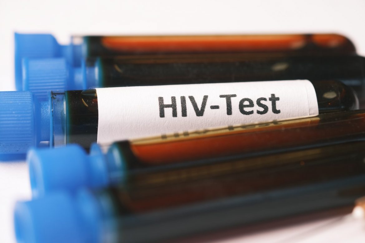 Test na HIV – fot. pexels